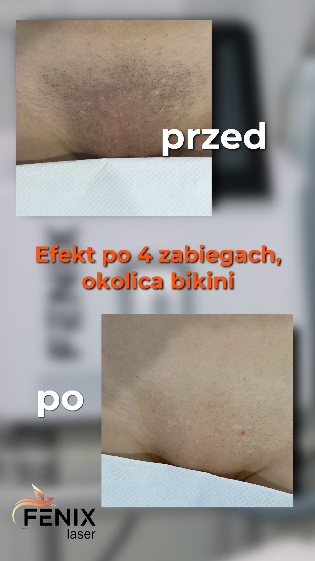 efekty1